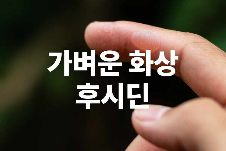 가벼운 화상 후시딘